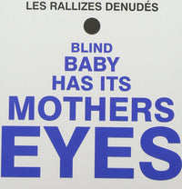 Blind Baby Has Its Mother's Eyes